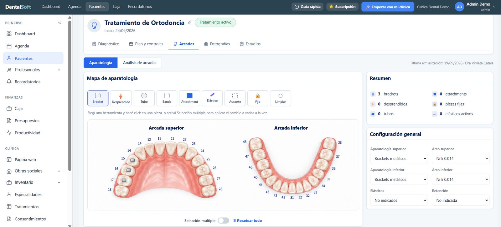 Mapa de aparatología de ortodoncia en DentalSoft con las arcadas superior e inferior, las herramientas de brackets y tubos y el resumen